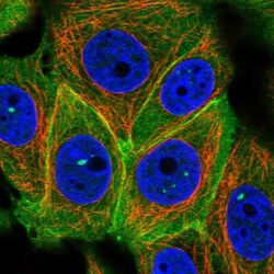 S100 calcium binding protein A14 Antibody, Novus Biologicals 0.1mL; Unlabeled:Antibodies,